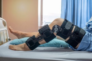 Los Angeles Arm And Leg Injury Lawyer