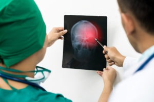 Los Angeles Brain Injury Lawyer