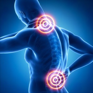 Los Angeles Paraplegia Injury Lawyer