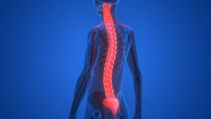 Los Angeles Spinal Cord Injury Lawyer